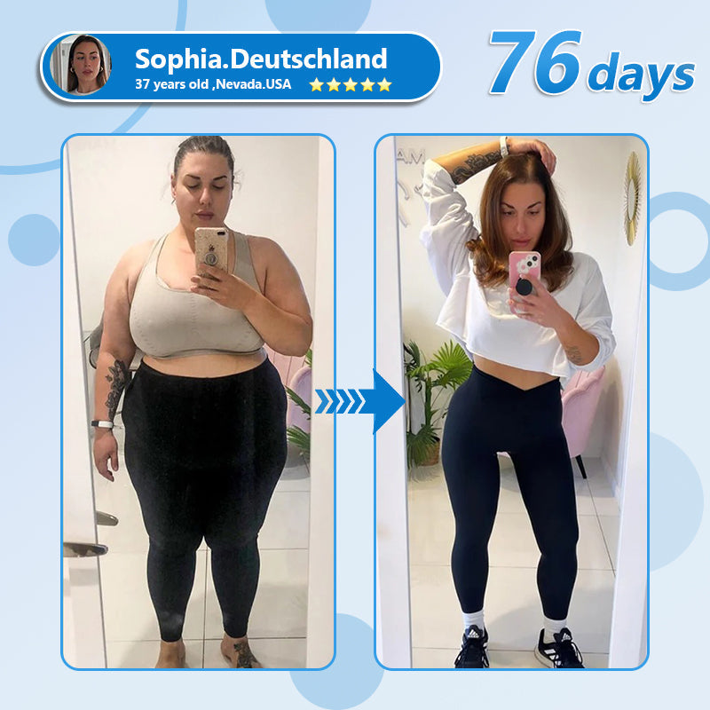 𝑪𝒓𝒐𝒂𝒊𝐞®💎 𝐍𝐚𝐧𝒐 𝐌𝐢𝐜𝐫𝒐𝐧𝐞𝐞𝐝𝐥𝐞 𝐏𝐚𝐭𝐜𝐡 𝐰𝐢𝐭𝐡 𝐒𝑴𝐆𝐓-𝐆𝑳𝐏-𝟏 & 𝑴𝐚𝐭𝐫𝐢𝐱𝐲𝐥 𝟑𝟎𝟎𝟎 – 𝐒𝐥𝐢𝗺𝐦𝐢𝐧𝐠, 𝐒𝐤𝐢𝐧 𝐓𝐢𝐠𝐡𝐭𝐞𝐧𝐢𝐧𝐠, 𝐁𝐥𝐨𝐨𝐝 𝐒𝐮𝐠𝐚𝐫 𝐒𝐮𝐩𝐩𝐨𝐫𝐭, 𝐍𝐨 𝐈𝐧𝐣𝐞𝐜𝐭𝐢𝐨𝐧, 𝟕-𝐃𝐚𝐲 𝐑𝐞𝐬𝐮𝐥𝐭✨