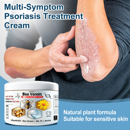 TODAHOF™🥑 Bee Venom Psoriasis Multi-Symptom Treatment Cream (👨‍⚕NPF RECOMMENDS)