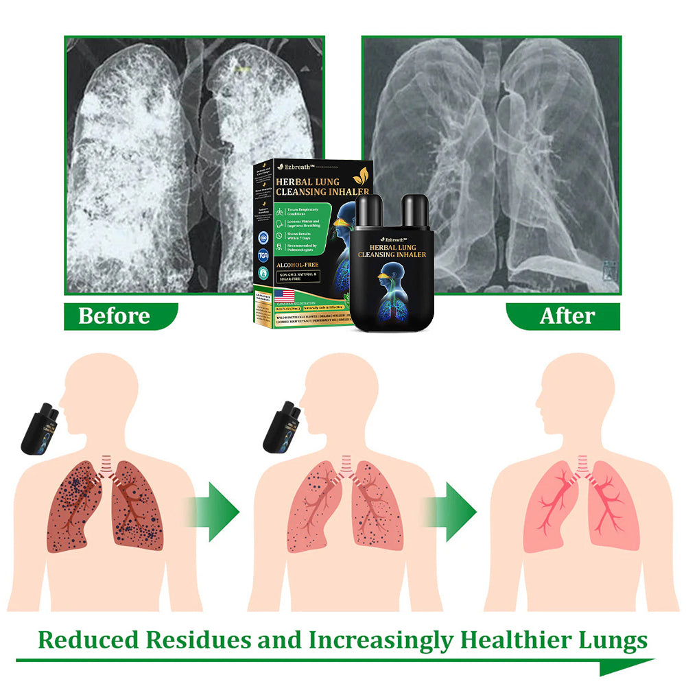 🎄✅Official Store: Ezbreath™ Herbal Lung Cleansing Inhaler (💝 Cough, wheezing, shortness of breath, sputum, stuffy nose, bronchitis, bronchitis, allergy symptoms, lung discomfort💝)