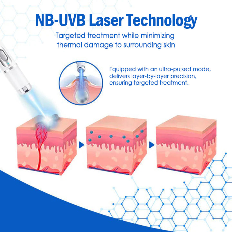 𝐇𝐄𝐀𝐓𝐖𝐎𝐋𝐅®👩‍⚕️ 𝐃𝒆𝐫𝐦𝒁𝐚𝐩 𝑵𝐁-𝐔𝐕𝐁 𝑴𝐨𝐥𝐞 & 𝑾𝐚𝐫𝐭 𝑹𝒆𝐦𝐨𝐯𝐚𝐥 𝑷𝐡𝐨𝐭𝐨𝐭𝐡𝐞𝐫𝐚𝐩𝐲 𝑳𝐚𝐬𝒆𝐫 𝑷𝐞𝐧 (Effectively inhibits excessive cell proliferation, eliminates inflammation and repairs the skin barrier)