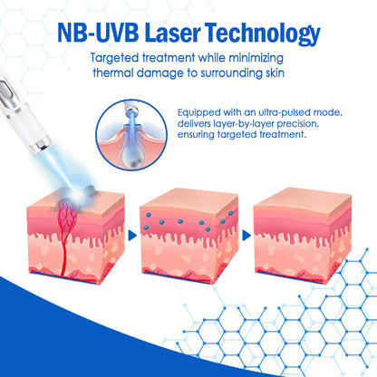 𝐇𝐄𝐀𝐓𝐖𝐎𝐋𝐅®👩‍⚕️ 𝐃𝒆𝐫𝐦𝒁𝐚𝐩 𝑵𝐁-𝐔𝐕𝐁 𝑴𝐨𝐥𝐞 & 𝑾𝐚𝐫𝐭 𝑹𝒆𝐦𝐨𝐯𝐚𝐥 𝑷𝐡𝐨𝐭𝐨𝐭𝐡𝐞𝐫𝐚𝐩𝐲 𝑳𝐚𝐬𝒆𝐫 𝑷𝐞𝐧 (Effectively inhibits excessive cell proliferation, eliminates inflammation and repairs the skin barrier)