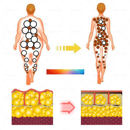 SIE𝖭𝖮𝖵𝖠™🥝 Portable Lymphatic Detox And Joint Relaxation Therapy Device👨‍⚕️Original 2-in-1 Therapy | Recommended by FDA✅