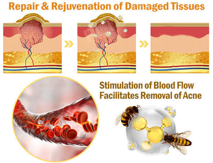 Steroid-Free🛡️ TODA𝗛OF™ 𝗜𝗻𝘁𝗲𝗻𝘀𝗶𝘃𝗲 𝗔𝗹𝗹-𝗕𝗼𝗱𝘆 𝗦𝗸𝗶𝗻 𝗧𝗿𝗲𝗮𝘁𝗺𝗲𝗻𝘁 𝗖𝗿𝗲𝗮𝗺 👩‍⚕️(𝗧𝗮𝗿𝗴𝗲𝘁𝘀 𝗠𝘂𝗹𝘁𝗶𝗽𝗹𝗲 𝗔𝗿𝗲𝗮𝘀 𝗮𝗻𝗱 𝗦𝗸𝗶𝗻 𝗜𝘀𝘀𝘂𝗲𝘀)