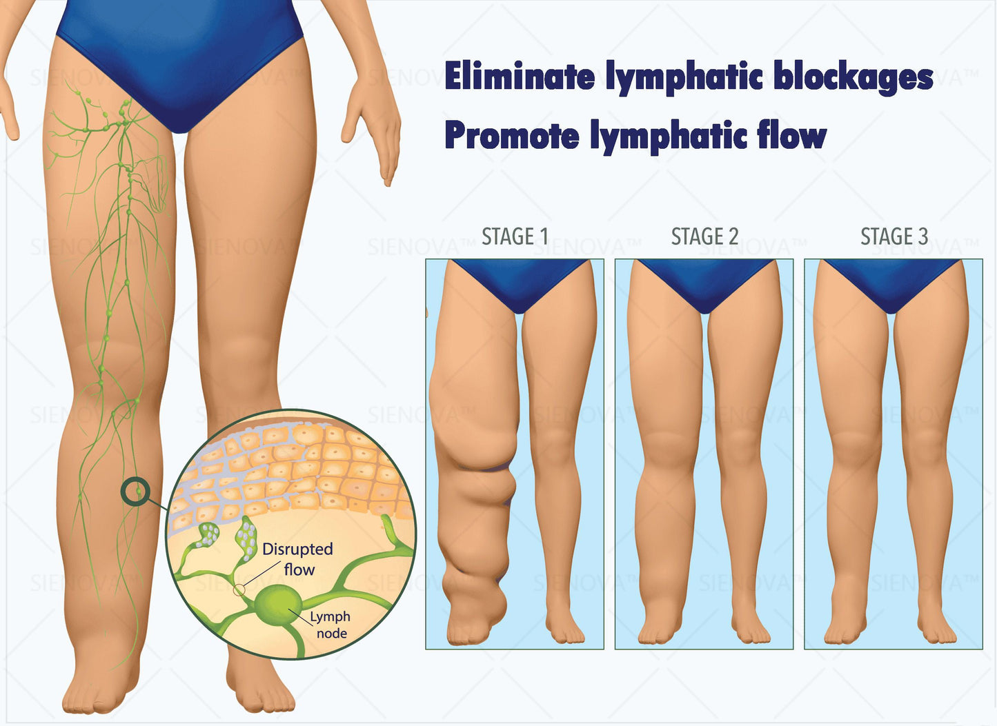 SIE𝖭𝖮𝖵𝖠™🥝 Portable Lymphatic Detox And Joint Relaxation Therapy Device👨‍⚕️Original 2-in-1 Therapy | Recommended by FDA✅