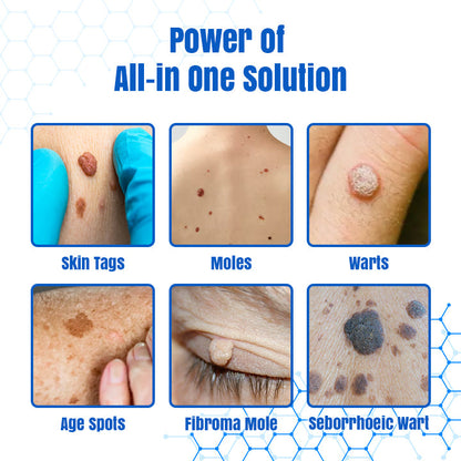 𝐇𝐄𝐀𝐓𝐖𝐎𝐋𝐅®👩‍⚕️ 𝐃𝒆𝐫𝐦𝒁𝐚𝐩 𝑵𝐁-𝐔𝐕𝐁 𝑴𝐨𝐥𝐞 & 𝑾𝐚𝐫𝐭 𝑹𝒆𝐦𝐨𝐯𝐚𝐥 𝑷𝐡𝐨𝐭𝐨𝐭𝐡𝐞𝐫𝐚𝐩𝐲 𝑳𝐚𝐬𝒆𝐫 𝑷𝐞𝐧 (Effectively inhibits excessive cell proliferation, eliminates inflammation and repairs the skin barrier)
