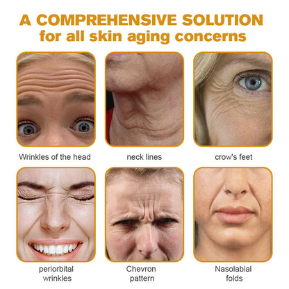 👨‍⚕️ Made and Shipped from USA✅ TLOPA™ Botox Bee Venom Wrinkle Removal Cream- LAST DAY 80% OFF