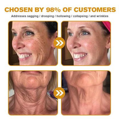 👨‍⚕️ Made and Shipped from USA✅ TLOPA™ Botox Bee Venom Wrinkle Removal Cream- LAST DAY 80% OFF