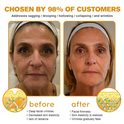 👨‍⚕️ Made and Shipped from USA✅ TLOPA™ Botox Bee Venom Wrinkle Removal Cream- LAST DAY 80% OFF